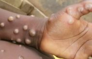 Pakistan'da Mpox Salgını: Yeni Vakalar Tespit Edildi